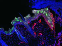 La inflamación entrena a la piel para repararse más rápido