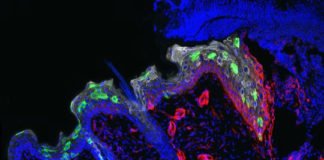 La inflamación entrena a la piel para repararse más rápido