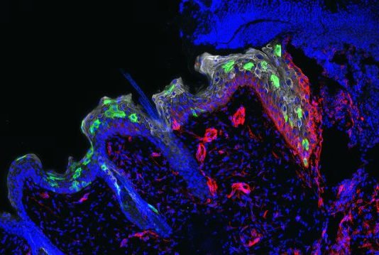 La inflamación entrena a la piel para repararse más rápido