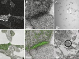 Primeras imágenes en color de un microscopio electrónico