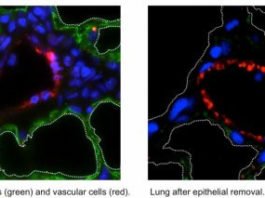 Desarrollan la primera estructura vascularizada funcional de pulmón