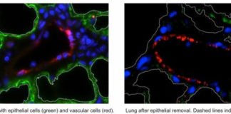 Desarrollan la primera estructura vascularizada funcional de pulmón