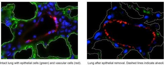 Desarrollan la primera estructura vascularizada funcional de pulmón