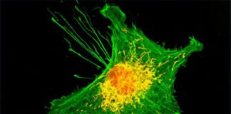 Dos proteínas controlan las líneas de suministro que alimentan el cáncer Cáncer