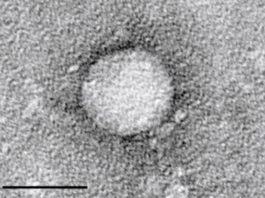 Curan la hepatitis C en pacientes transplantados de riñón infectado por la enfermedad