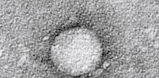 Curan la hepatitis C en pacientes transplantados de riñón infectado por la enfermedad