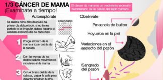 Cáncer de mama ER+: Nuevo biomarcador importante, que predice el resultado de la terapia y es un posible objetivo farmacológico Cáncer de mama exploración