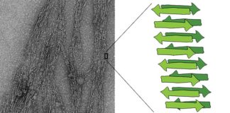 La proteína amiloide se autorreplica: ¿Puede ser la precursora de la vida en la Tierra?