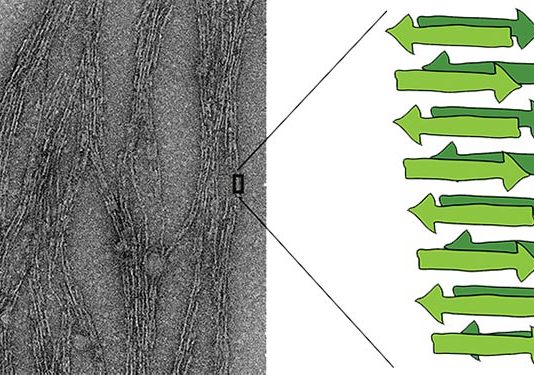 La proteína amiloide se autorreplica: ¿Puede ser la precursora de la vida en la Tierra?