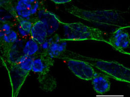 Un nuevo tratamiento contra la apoplejía basado en células madre repara el tejido cerebral dañado