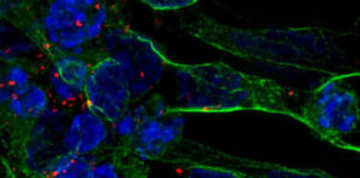 Un nuevo tratamiento contra la apoplejía basado en células madre repara el tejido cerebral dañado