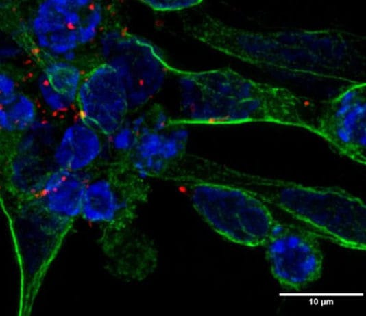 Un nuevo tratamiento contra la apoplejía basado en células madre repara el tejido cerebral dañado