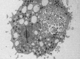 Un estudio descubre cómo la bacteria del cólera ha llegado a ser tan peligrosa Vibrio cholerae en una ameba