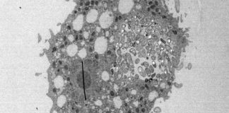 Un estudio descubre cómo la bacteria del cólera ha llegado a ser tan peligrosa Vibrio cholerae en una ameba