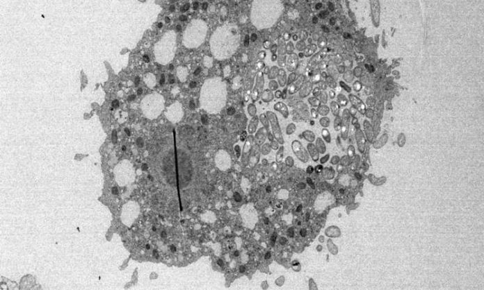 Vibrio cholerae en una ameba