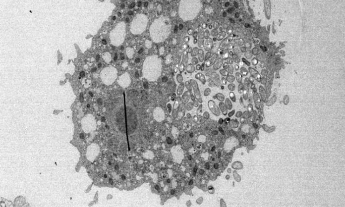 Vibrio cholerae en una ameba Vibrio cholerae en una ameba