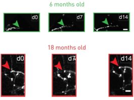 Envejecimiento: El antidepresivo fluoxetina restaura la flexibilidad juvenil de las neuronas inhibitorias en ratones envejecimiento