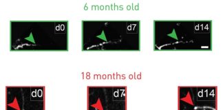 Envejecimiento: El antidepresivo fluoxetina restaura la flexibilidad juvenil de las neuronas inhibitorias en ratones envejecimiento