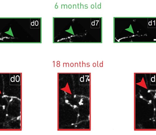 Envejecimiento: El antidepresivo fluoxetina restaura la flexibilidad juvenil de las neuronas inhibitorias en ratones envejecimiento