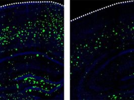 Descubren que un medicamento ya desarrollado funciona también para tratar el Alzheimer en sus primeras fases 3K3A-APC reduce la cantidad de β-amiloide en el cerebro de ratones