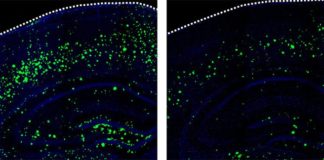 Descubren que un medicamento ya desarrollado funciona también para tratar el Alzheimer en sus primeras fases 3K3A-APC reduce la cantidad de β-amiloide en el cerebro de ratones