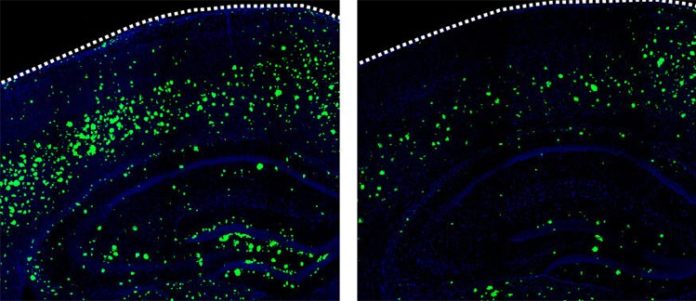 3K3A-APC reduce la cantidad de β-amiloide en el cerebro de ratones
