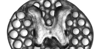 Un implante impreso en 3D promueve el crecimiento de las células nerviosas para tratar la lesión de médula espinal Implante impreso en 3D para lesiones de médula espinal