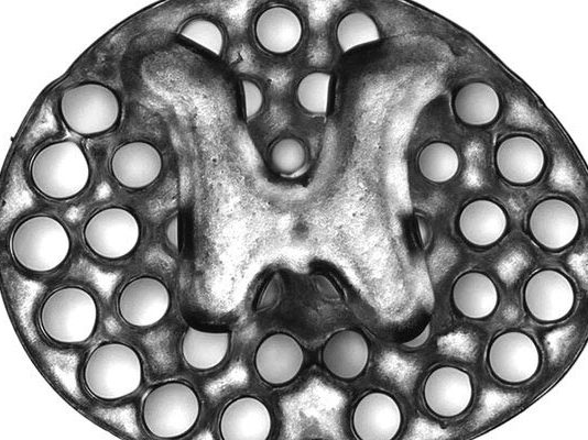 Un implante impreso en 3D promueve el crecimiento de las células nerviosas para tratar la lesión de médula espinal Implante impreso en 3D para lesiones de médula espinal