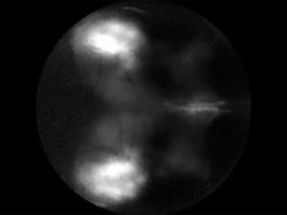 Un estudio con ratones examina los fundamentos de las alucinaciones Respuesta neural a los estímulos visuales en ratón