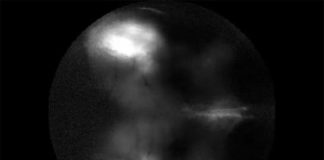 Un estudio con ratones examina los fundamentos de las alucinaciones Respuesta neural a los estímulos visuales en ratón