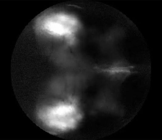 Un estudio con ratones examina los fundamentos de las alucinaciones Respuesta neural a los estímulos visuales en ratón