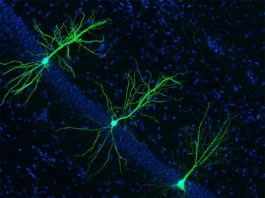 La supresión de una nueva enzima podría prevenir y combatir el Alzheimer La supresión de una nueva enzima podría prevenir y combatir el Alzheimer