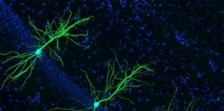 La supresión de una nueva enzima podría prevenir y combatir el Alzheimer La supresión de una nueva enzima podría prevenir y combatir el Alzheimer