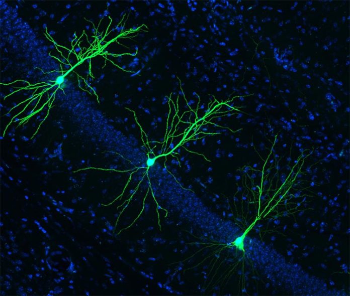 La supresión de una nueva enzima podría prevenir y combatir el Alzheimer La supresión de una nueva enzima podría prevenir y combatir el Alzheimer