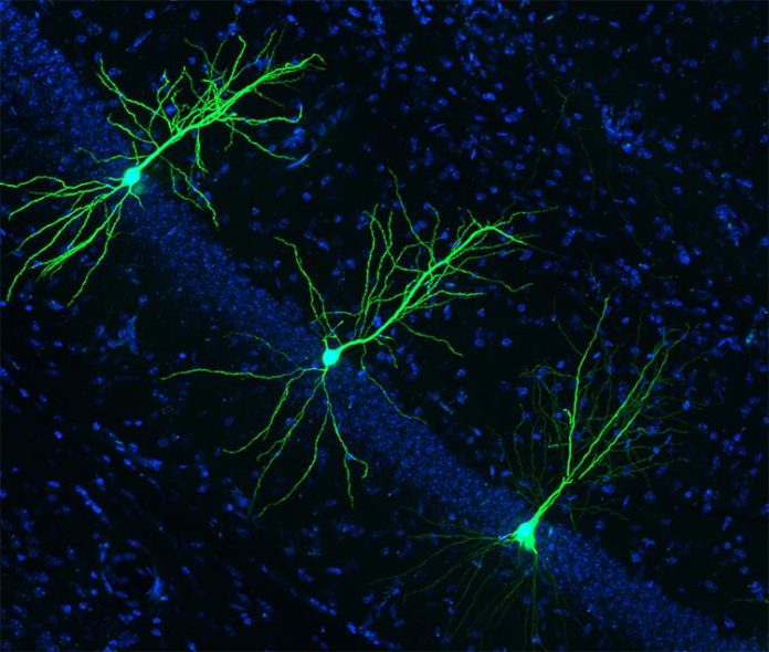 La supresión de una nueva enzima podría prevenir y combatir el Alzheimer