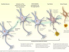 Nuevo estudio sobre las proteínas tau del cerebro podría ayudar a abordar la demencia Alzheimer: proteínas tau