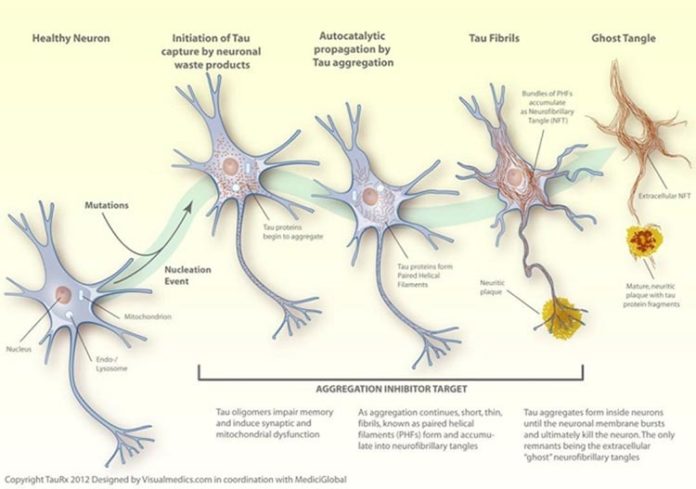 Alzheimer: proteínas tau