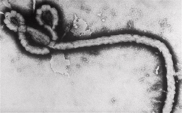 Virus del ébola