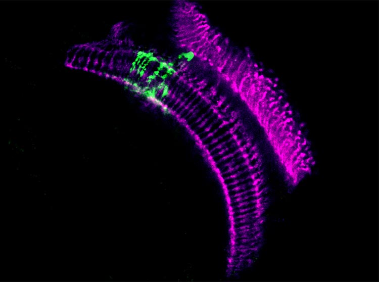 Lamina y médula del lóbulo óptico de la mosca. Fotorreceptores en magenta y clon Dm9 en verde