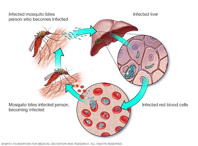 Ciclo de la infección por malaria