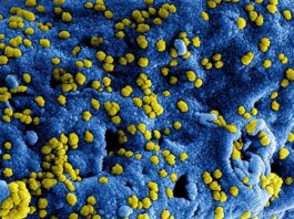 El Remdesivir previene la enfermedad por coronavirus MERS en monos Coronavirus del síndrome respiratorio del Medio Este (MERS-CoV)
