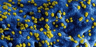 El Remdesivir previene la enfermedad por coronavirus MERS en monos Coronavirus del síndrome respiratorio del Medio Este (MERS-CoV)
