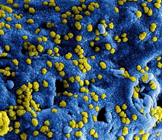 El Remdesivir previene la enfermedad por coronavirus MERS en monos Coronavirus del síndrome respiratorio del Medio Este (MERS-CoV)
