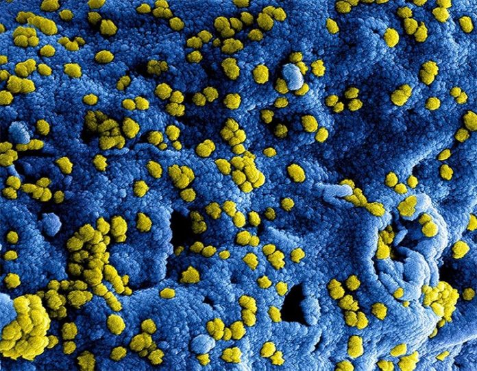 Coronavirus del síndrome respiratorio del Medio Este (MERS-CoV)