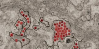 Una vacuna contra el Zika induce potentes anticuerpos contra el Zika y el dengue Partículas del virus del Zika (rojo) que se muestran en las células renales de un mono verde africano Crédito: NIAID.