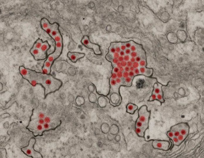 Partículas del virus del Zika (rojo) que se muestran en las células renales de un mono verde africano Crédito: NIAID.