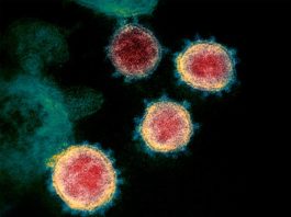 Los científicos cuestionan la fiabilidad de las pruebas rápidas para el COVID-19 El coronavirus COVID-19 visto al microscopio