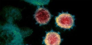 Los científicos cuestionan la fiabilidad de las pruebas rápidas para el COVID-19 El coronavirus COVID-19 visto al microscopio