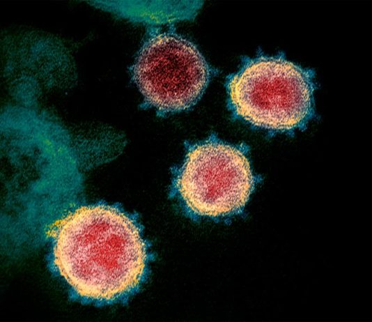Los científicos cuestionan la fiabilidad de las pruebas rápidas para el COVID-19 El coronavirus COVID-19 visto al microscopio