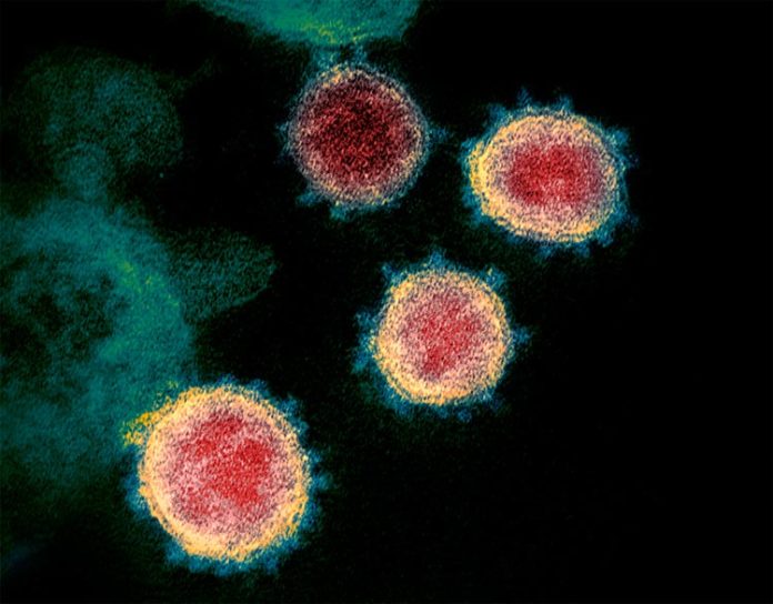 El coronavirus COVID-19 visto al microscopio